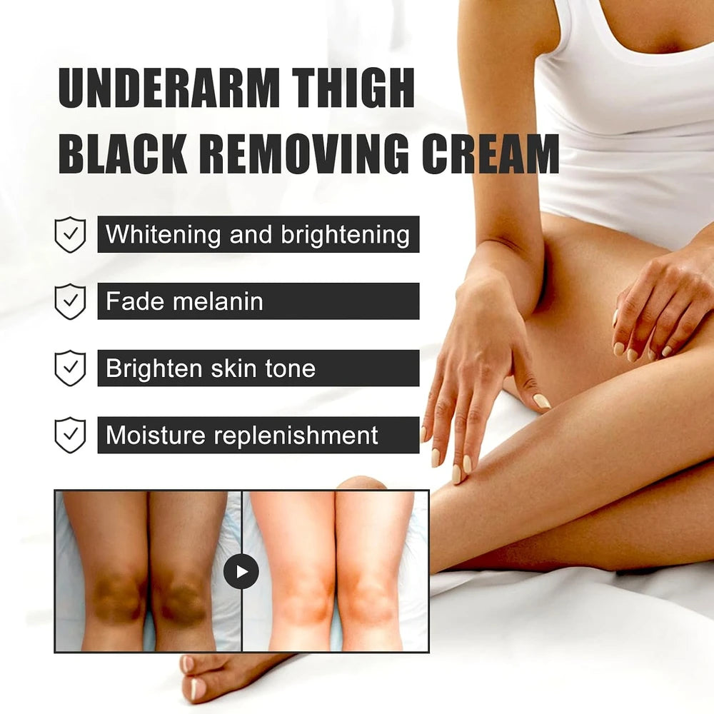 Femme Skin Lightening Cream