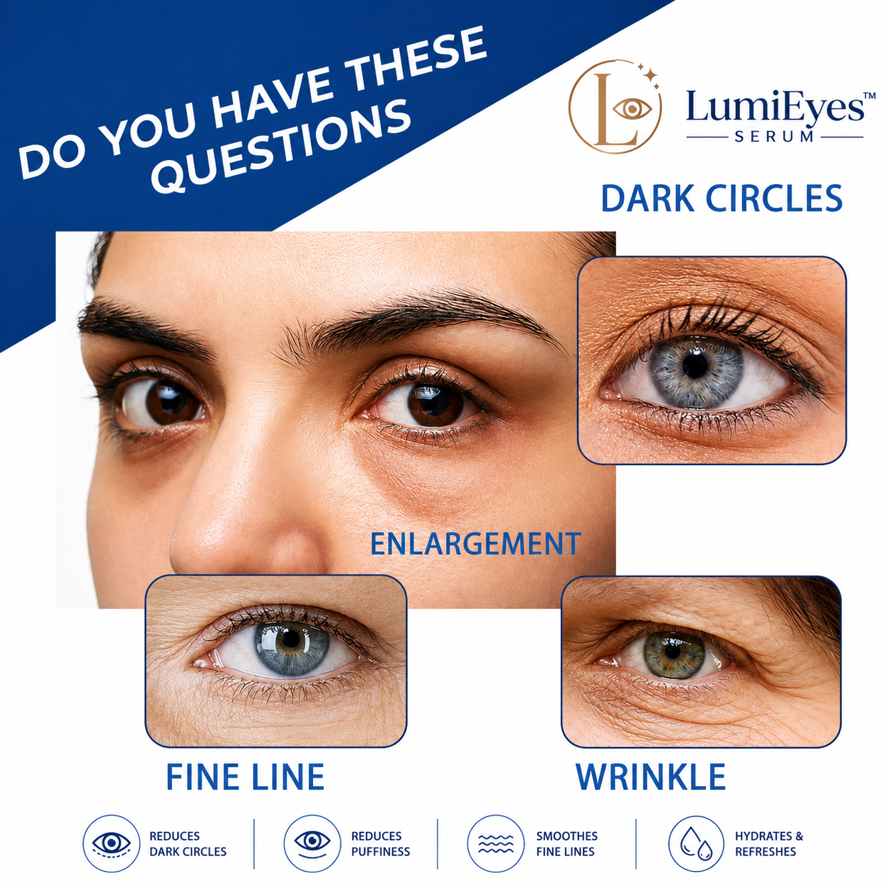 LumiEyes™ Serum ingredient callout graphic