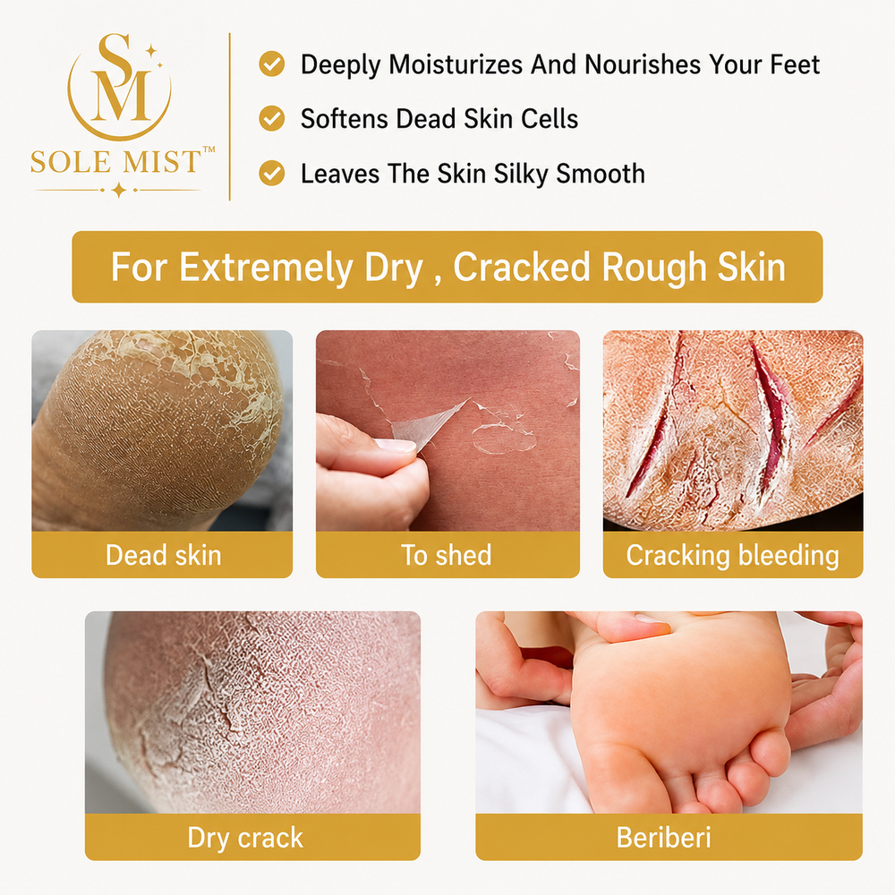 Sole MIST™ Exfoliating Foot Spray packaging