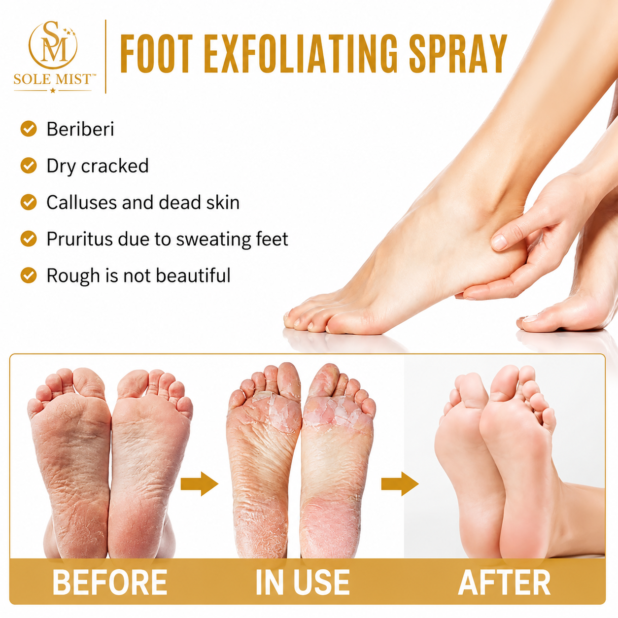 Sole MIST™ Exfoliating Foot Spray nozzle close-up